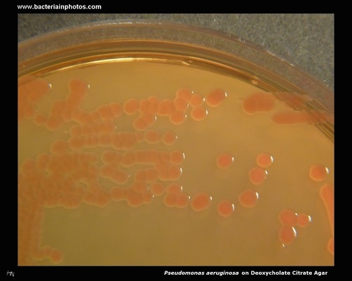 pseudomonas on deoxycholate citrate agar